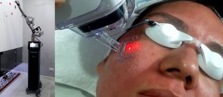 clinicas quitar cicatrices con laser trujillo Dermaláser Chernan ZAPATA
